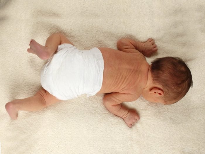 Do Cloth Diapers Cause Diaper Rash