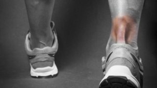 Black and white back view of someone's feet in sneakers with a reddened Achilles tendon.