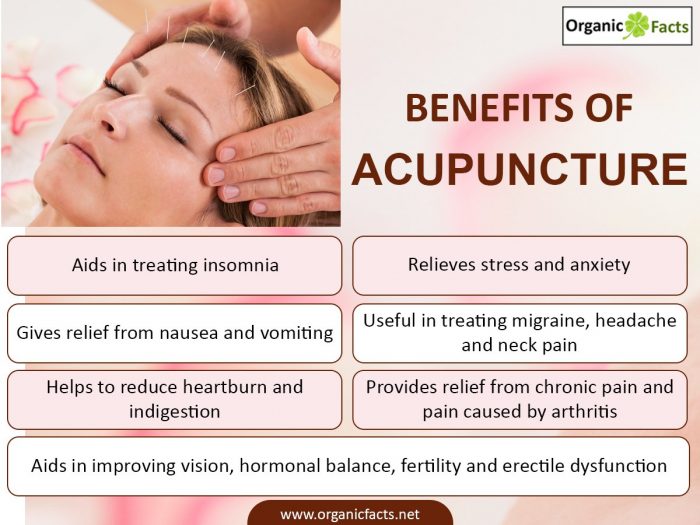 An infographic on the health benefits of acupuncture