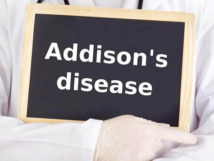 addisonsdisease