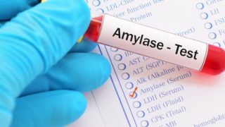 Gloved hand holding test-tube labeled 'Amylase Test'