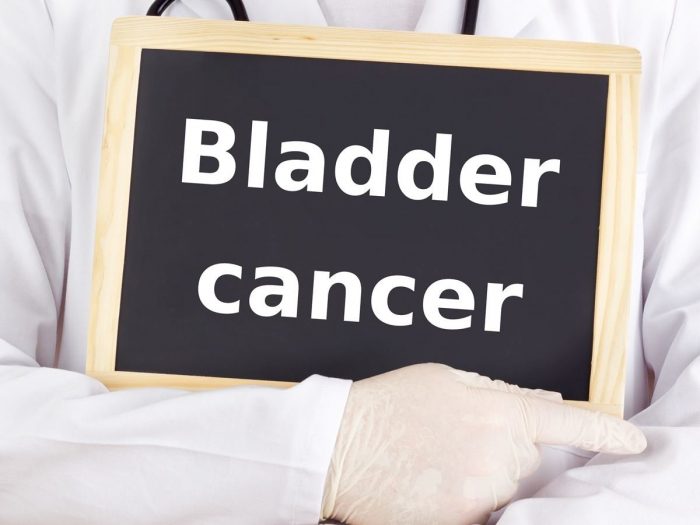 Bladder cancer written on a chalkboard