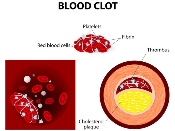 does blood pressure medicine cause blood clots