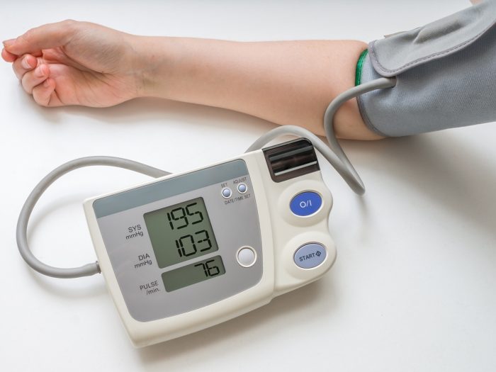 A machine monitoring the blood pressure and pulse