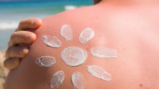 8 Amazing Benefits of Coconut Oil for Sunburn