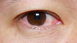 A close-up shot of a human eye