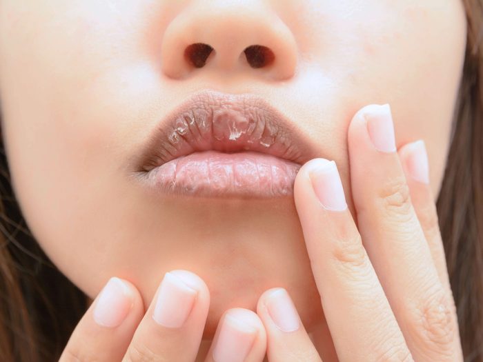 12 Effective Remedies for Dry Mouth Organic Facts