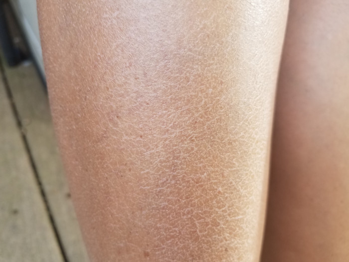 11 Effective Home Remedies for Dry Skin Organic Facts