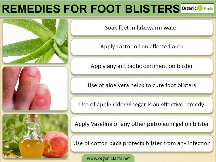An infographic on the home remedies for foot blisters
