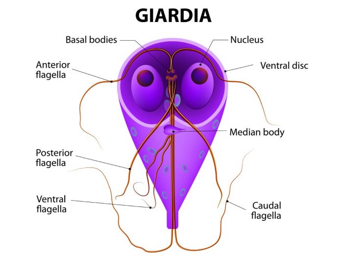 giardiasis