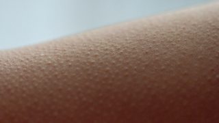 Close-up of skin with goosebumps