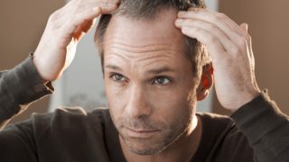 16 Amazing Home Remedies for Hair Loss