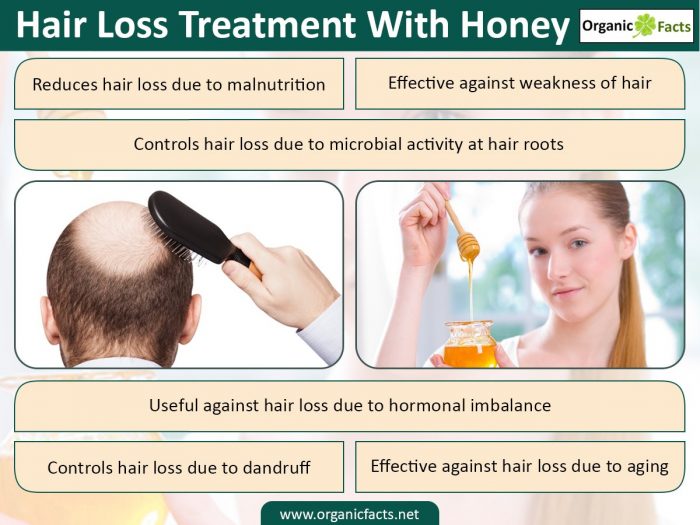 An infographic on information on hair loss treatment with honey