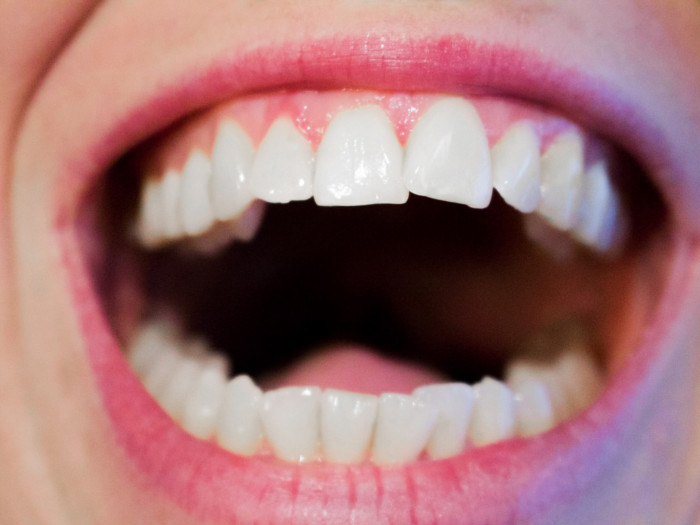 Showing white teeth and healthy gums