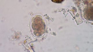 Eggs of hookworm in a stool seen through a microscope