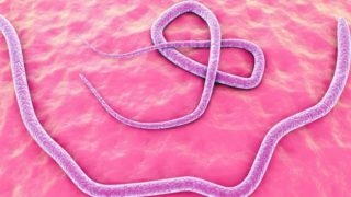 2D illustration of a worm infestation in the human intestines