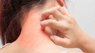 9 Proven Essential Oils for Itching