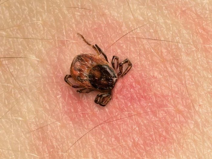 Human skin with a tick bite and tick on it