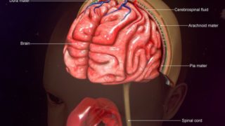 3D medical illustration of a human skull suffering from meningitis