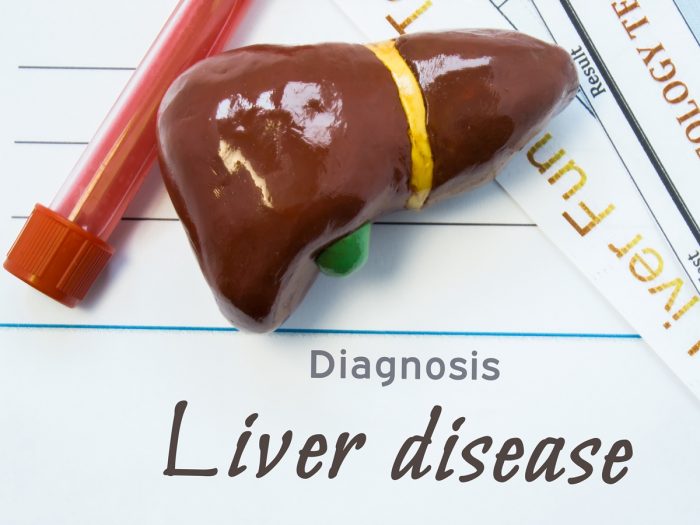 An unhealthy-looking liver placed over a whiteboard which says 'liver diseases' at the bottom