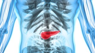 An x-ray image of pancreatitis