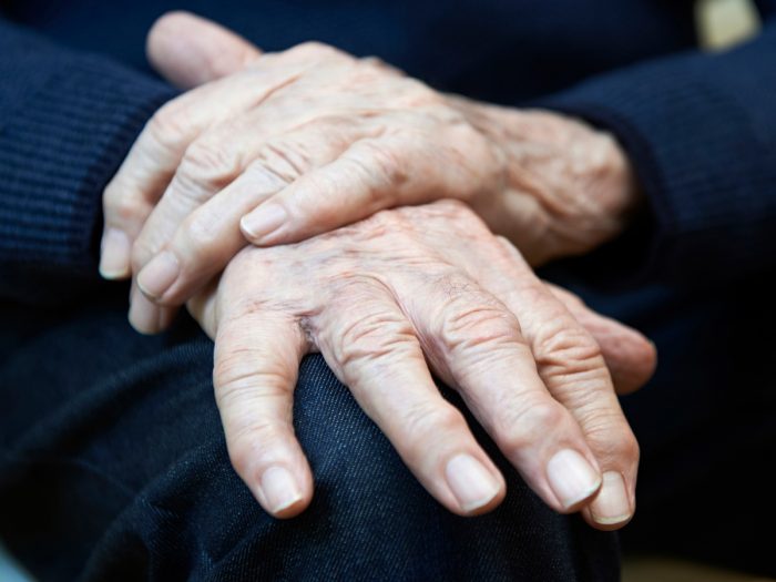 Hands of a Parkinson's disease patient