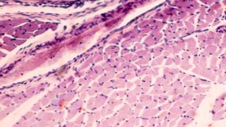 Extreme close-up of muscle tissues.