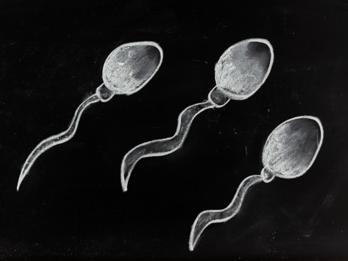 A graphic of three sperms on a black background.