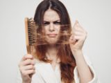 womenhairloss 160x120 - MANNELIJK KAALHEID: OORZAKEN, SYMPTOMEN & BEHANDELINGEN